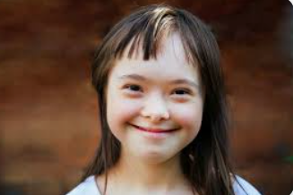 Top 10 Questions About Down Syndrome: Simple Answers to Broaden Your Understanding