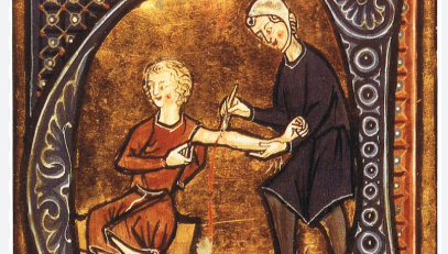 Top 10 Ways Doctors Performed Surgery Before Anesthesia